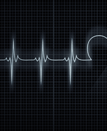 Electrocardiogramme