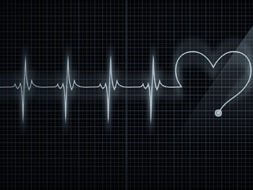 Electrocardiogramme