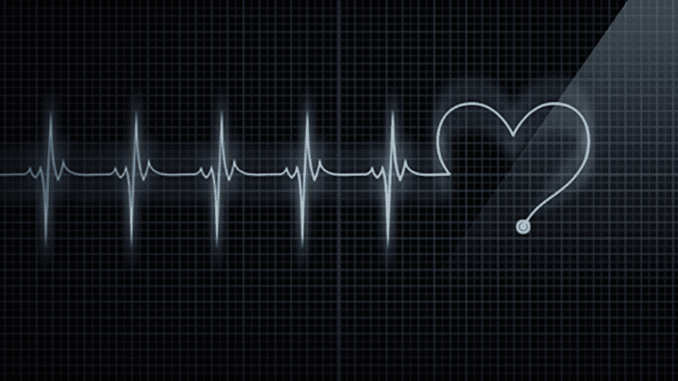 Electrocardiogramme