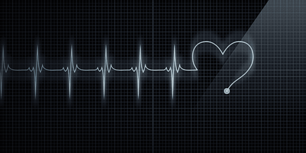 Electrocardiogramme